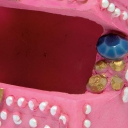 SfdecotreasureboxSuperfish-Superfish